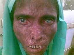 jesus heals a man with leprosy daily prayers