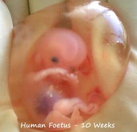 Human Foetus at 10wks