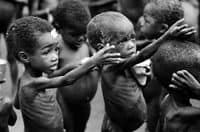 Malnourished Children seeking help