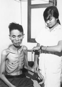 Emaciated Vietnamese Prisoner 1966